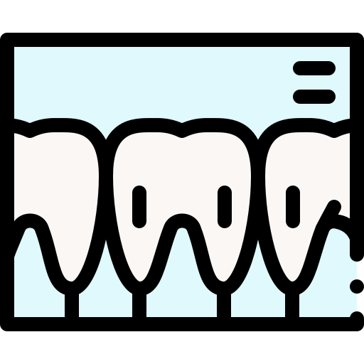 X ray
